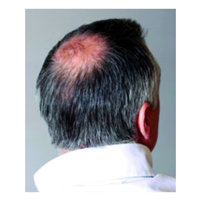 Blum Secret Densificador Capilar 12g  Nº 9 Gris